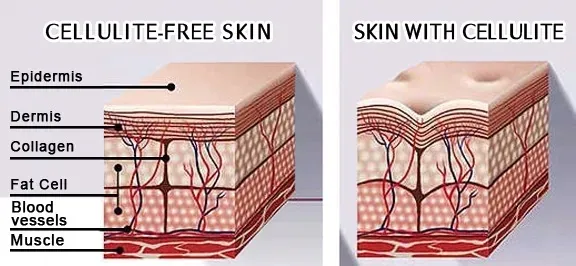 profesjonalne-ampulki-na-cellulitcelulitdetocell-stan-nowy