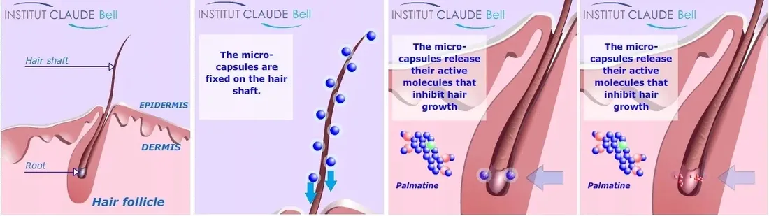 redecteur-de-pilosite-hamuje-wzrost-wlosowslabsze-zanikpachybikini