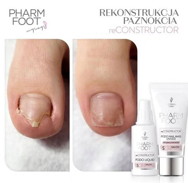 pharm-foot-reconstructor-podo-nail-set-uv-led-kod-producenta-565132