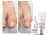 pharm-foot-reconstructor-podo-nail-set-uv-led-wyrob-medyczny-nie
