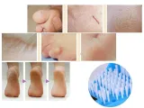 3w1-zestaw-pod-prysznic-myjka-szczotka-kapcie-klapki-do-mycia-stop-plecow-kod-producenta-spa-feet-2x-253