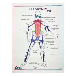 tablica-anatomiczna-plakat-lipodynie-tyl