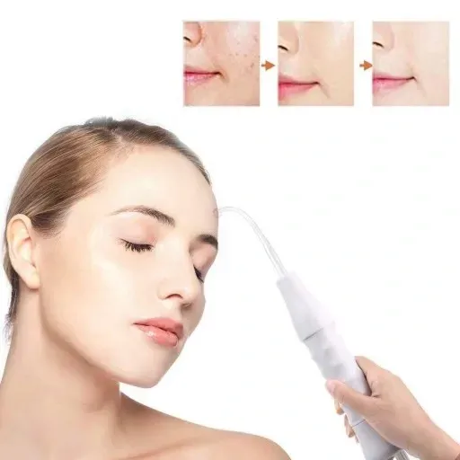 darsonval-derma-wand-darsonwal-mocny-4-peloty