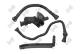 odma-separator-oleju-bmw-e87-e46-e91-e83-zestaw-typ-silnika-benzyna