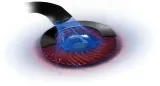 tarcza-hamulcowa-shw-performance-bfr42502-numer-katalogowy-czesci-bfr42502