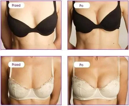 zel-sprej-perfect-bust-gel-150ml