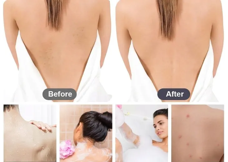 myjka-recznik-do-masazu-peelingu-zluszczania-plecow-ciala-granatowy-90cm-kod-producenta-myjka-do-masazu-strefazakupow