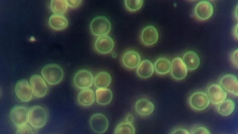 kondensor-ciemnego-pola-olejowy
