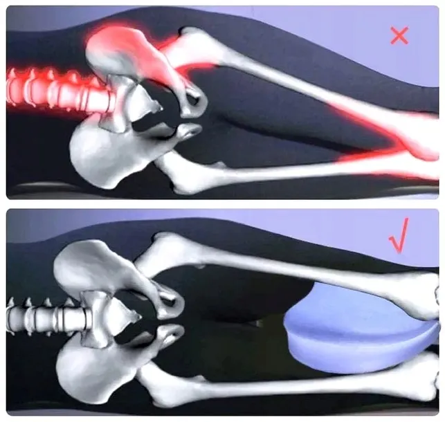 poduszka-ortopedyczna-klin-miedzy-nogi-kolana-do-spania-separator-pokrowiec-rodzaj-do-spania