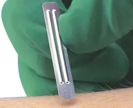 lancety-do-przeprowadzenia-testow-alergicznych