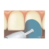 3m-espe-trzymadelko-mandrylka-do-sof-lex-rodzaj-inny