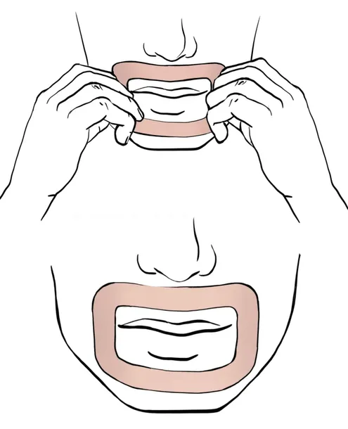 plastry-myotape-dla-dzieci-na-usta-chrapanie-90szt-rozm-s-bezowe-oryginalne-wyrob-medyczny-nie