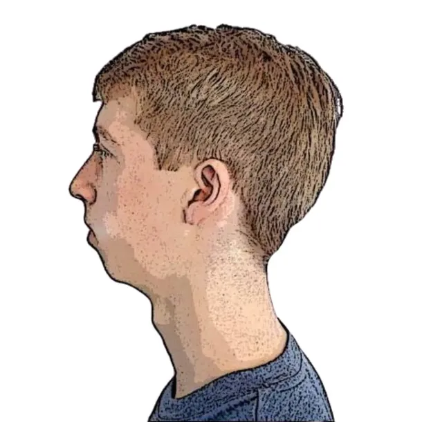 plastry-myotape-dla-dzieci-na-usta-chrapanie-90szt-rozm-s-bezowe-oryginalne-stan-nowy-stan-opakowania-oryginalne