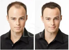 wlokna-mikrowlokna-w-sprayu-wodoodporne-zageszczanie-wlosow-naturalny-efekt