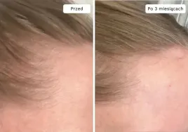 wcierka-serum-na-porost-i-wypadanie-wlosow-wzmacnia-cebulki-lavress-10w1