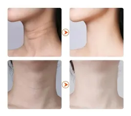 masazer-do-ujedrnia-szyi-i-twarzy-mezoterapia-led-wibracja-cieply-prad-rf