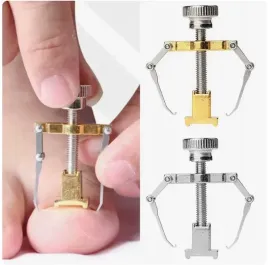 klamra-korekcyjna-na-wrastajace-paznokcie