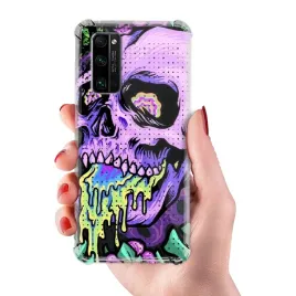 etui-do-huawei-honor-30-pro-antishock-mocne-dla-nastolatkow-dark-trendy-wz