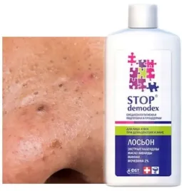 tonik-na-pryszcze-wagry-zaskorniki-mocny-150ml
