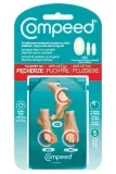 compeed-plastry-na-pecherze-mix-5-sztuk