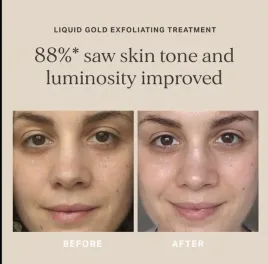 alpha-h-liquid-gold-tonik-kuracja-serum-z-kwasem-glikolowym-50-ml-1-69fl-oz