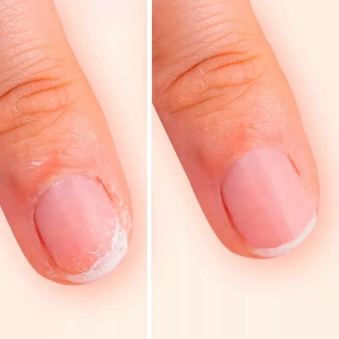 manucurist-keratin-booster-15ml-przeznaczenie-do-paznokci