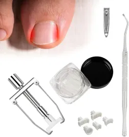 zestaw-do-korekcji-wrastajacych-paznokci-akcesoria-do-korekcji-stop-x12