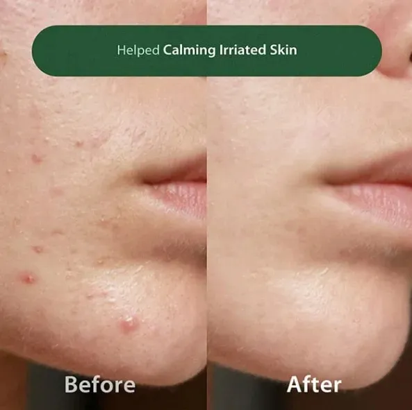 blithe-anti-polluaging-pore-cleansing-foam-bha-oczyszczajaca-pianka-rodzaj-inny