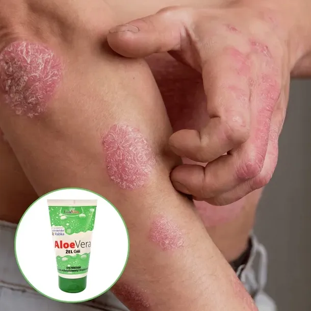 gorvita-aloe-vera-zel-150-ml-marka-gorvita