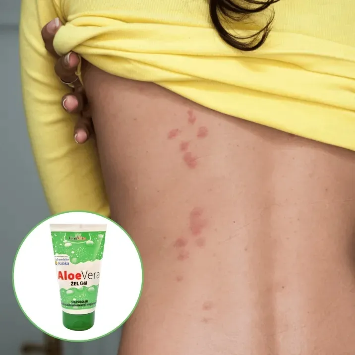 gorvita-aloe-vera-zel-150-ml-stan-nowy
