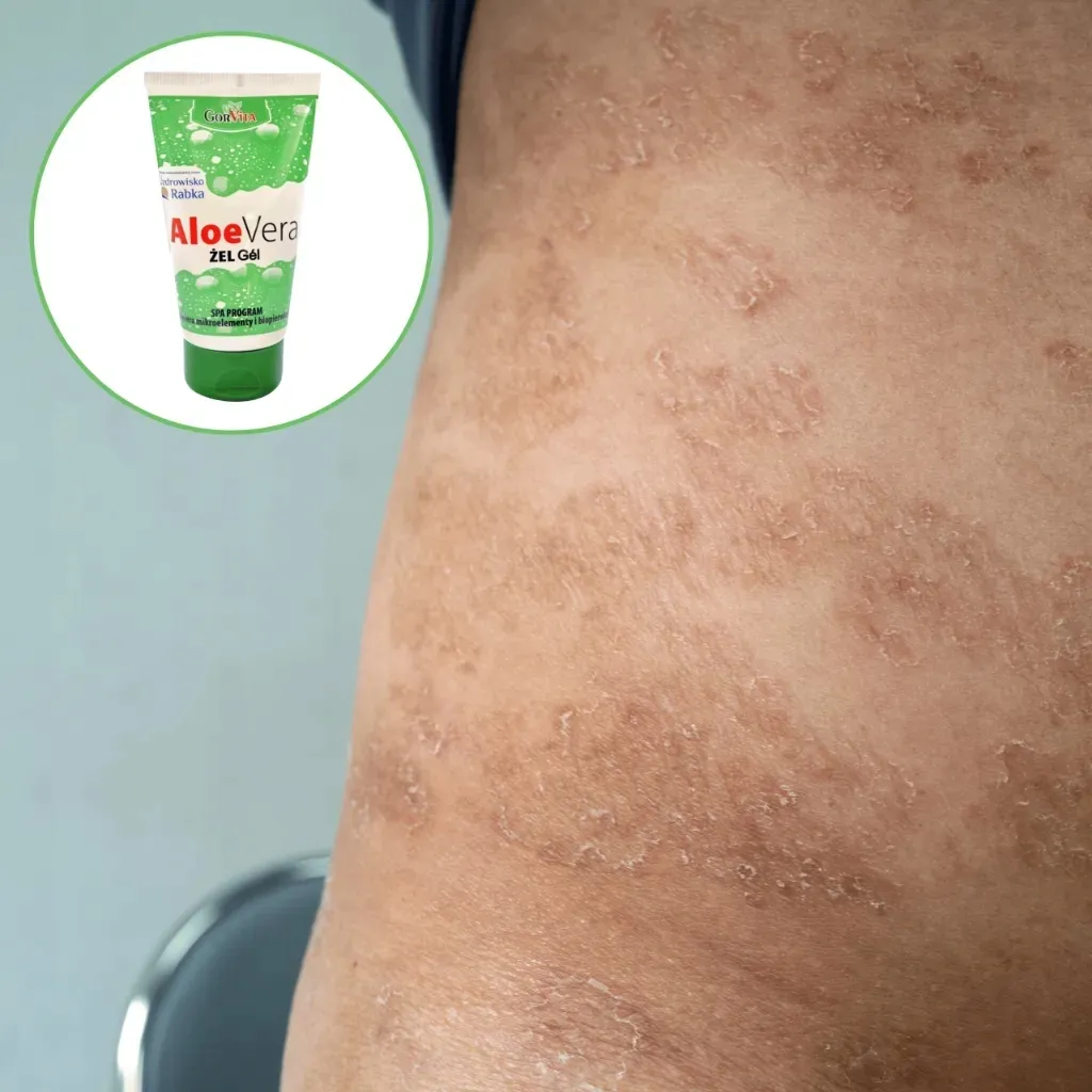 gorvita-aloe-vera-zel-150-ml
