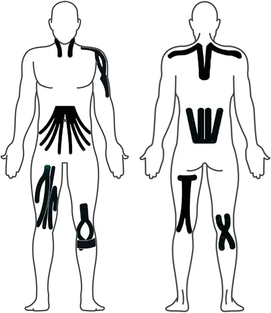 tasma-kinezjologiczna-do-tapingu-sportowa-25-szt-czarna-25-cm-5-cm-dlugosc-25-m