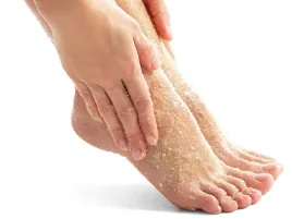 peeling-solny-do-stop-mechaniczny-zluszczajacy-wygladzajacy-regenerujacy