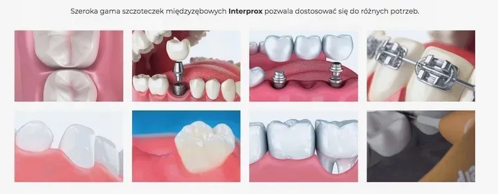 interprox-plus-2g-dentaid-17-conic-6-szt