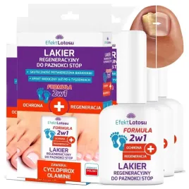 lakier-preparat-na-grzybice-paznokci-stop-przeciwgrzybiczny-ochrona-3x