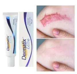 dermatix-ultra-silikonowy-zel-do-leczenia-i-zapobiegania-blizn-15g