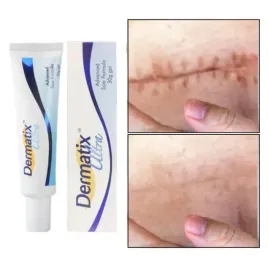 dermatix-ultra-silikonowy-zel-do-leczenia-i-zapobiegania-blizn-15g