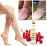 na-zylaki-i-pajaczki-uczucie-ciezkich-nog-olej-rycynowy-oryginalny-z-stan-nowy