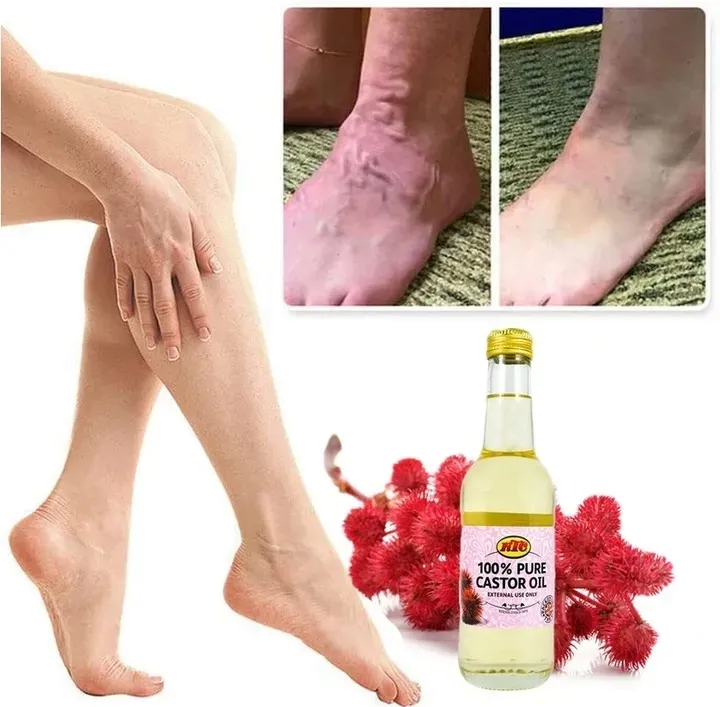 na-zylaki-i-pajaczki-uczucie-ciezkich-nog-olej-rycynowy-oryginalny-z