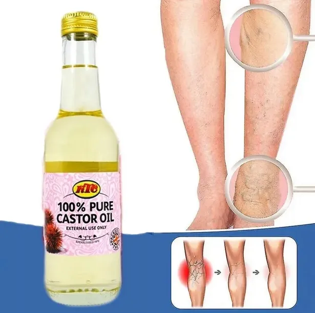 na-zylaki-i-pajaczki-uczucie-ciezkich-nog-olej-rycynowy-oryginalny-z-wielkosc-produkt-pelnowymiarowy