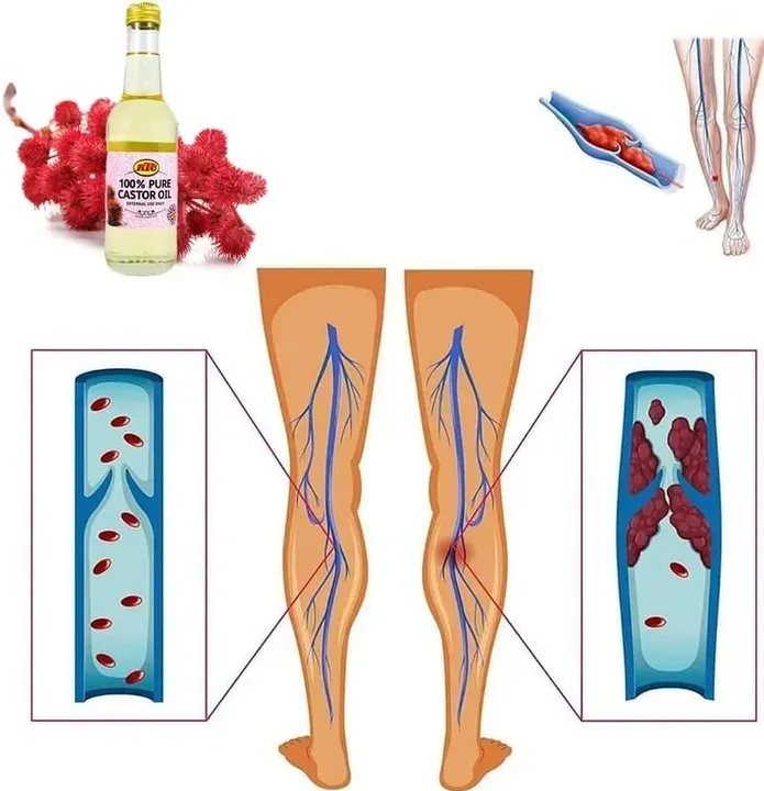 na-zylaki-i-pajaczki-uczucie-ciezkich-nog-olej-rycynowy-oryginalny-z-stan-nowy