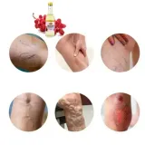 na-zylaki-i-pajaczki-uczucie-ciezkich-nog-olej-rycynowy-oryginalny-z-produkt-nie-zawiera-alkoholu-aluminium-amoniaku-olejow-mineralnych-parabenow-parafiny-peg-silikonow-skladnikow-pochodzenia-zwierzecego-sles-sls-substancji-zapachowych-siarczanow-mydla-barwnikow