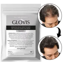 wlokna-glovis-50g-eko-saszetka-mikrowlokna-zageszczanie-rzadkich