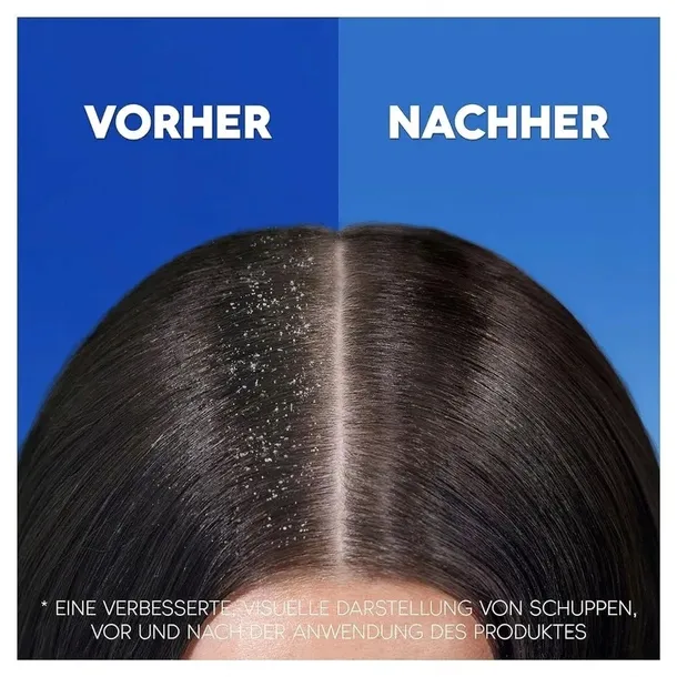 head-and-shoulders-classic-clean-szampon-800ml-produkt-nie-zawiera-skladnikow-pochodzenia-zwierzecego