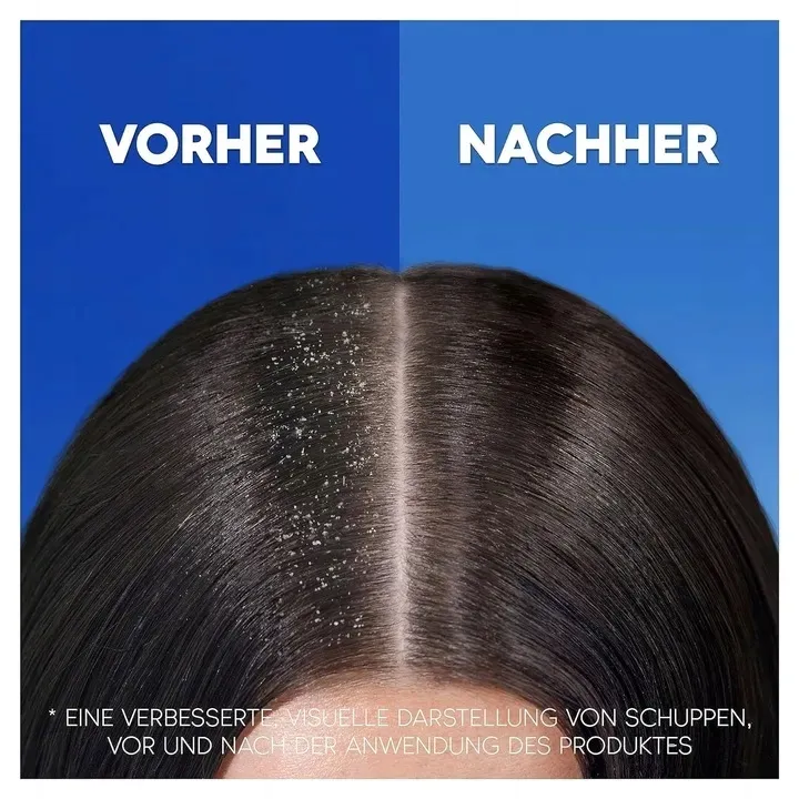 head-and-shoulders-classic-clean-szampon-800ml