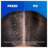 head-and-shoulders-classic-clean-szampon-800ml-linia-classic