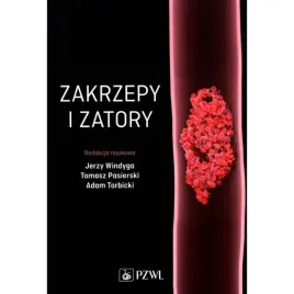 zakrzepy-i-zatory-praca-zbiorowa