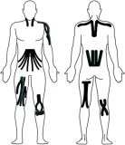tasma-kinesiotaping-kinesio-do-tapingu-25x5cm-dlugosc-25-m