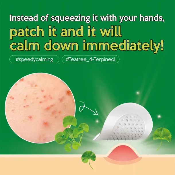 troubless-micro-point-patch-plastry-na-niedoskonalosci-9szt-pojemnosc-9-l