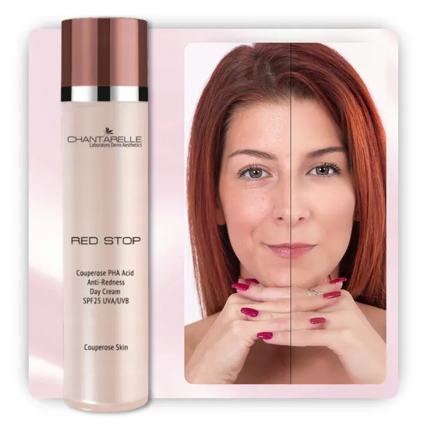 krem-do-twarzy-na-dzien-redukujacy-zaczerwienienia-chantarelle-red-stop-rodzaj-na-dzien